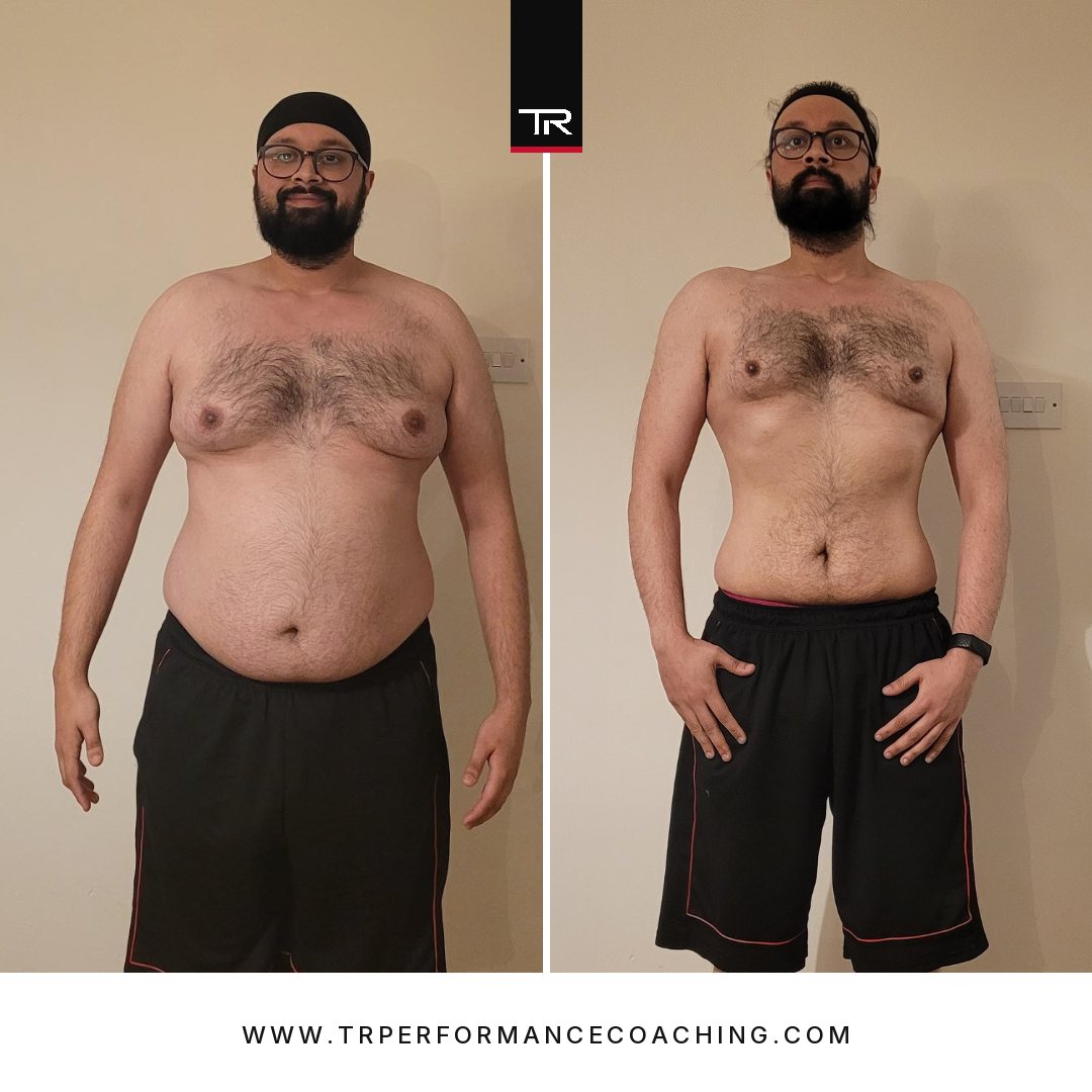 Dr Jeetpal Singh before and after